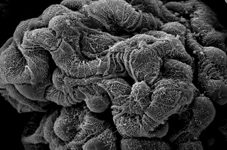 Healthy Glomerulus